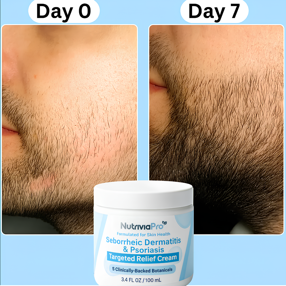 NutriviaPro - Beard Recovery Cream®