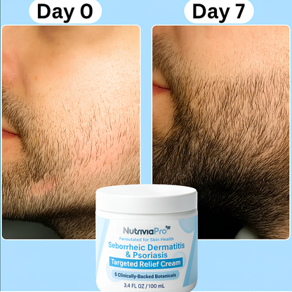NutriviaPro - Beard Recovery Cream®